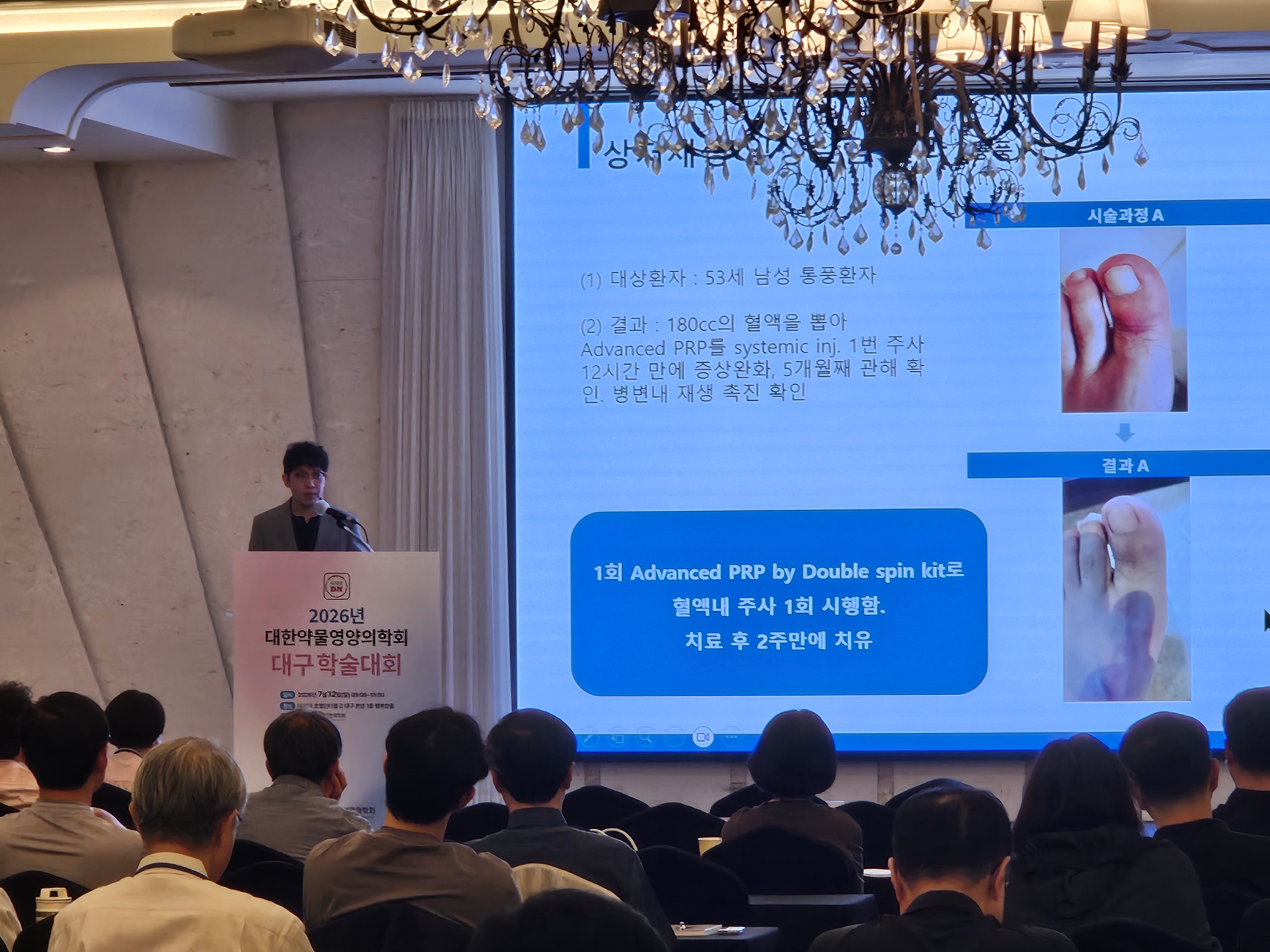 줄기세포주사,강남줄기세포